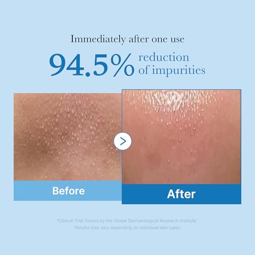 MEDICUBE Zero Foam Cleanser 120g