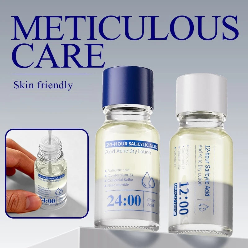 Korean Salicylic Acid Acne Remove Lotion 10ml Reduce Facial Dryness Acne Control Oil Refresh Not Greasy Day&Night Double Repair