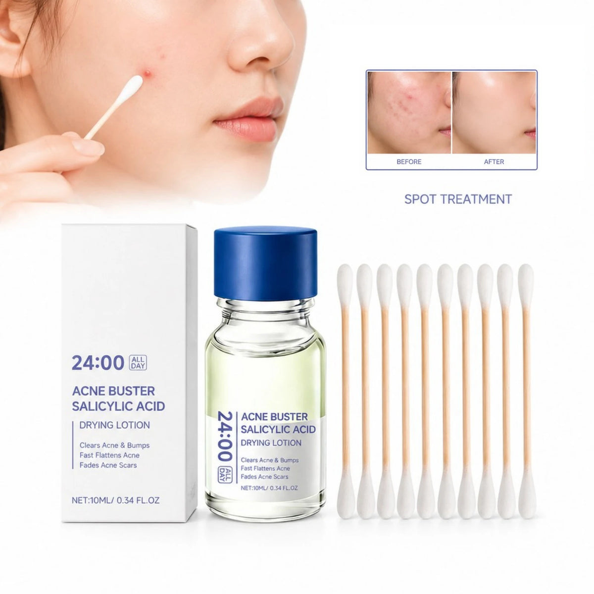 Salicylic Acid Acne Treatment Serum Moisturizing Oil Control Spot Corrector Pimple Relief Fades Acne Mark Facial Skin Care Serum