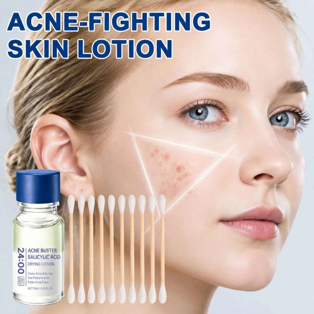 Salicylic Acid Acne Treatment Serum Moisturizing Oil Control Spot Corrector Pimple Relief Fades Acne Mark Facial Skin Care Serum