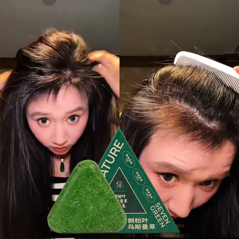 Green Shampoo Bar For Hair Growth Anti Hair Loss Control Oil & Dandruff Removal With Arborvitae & Usmania Herbs For Thicker Hair