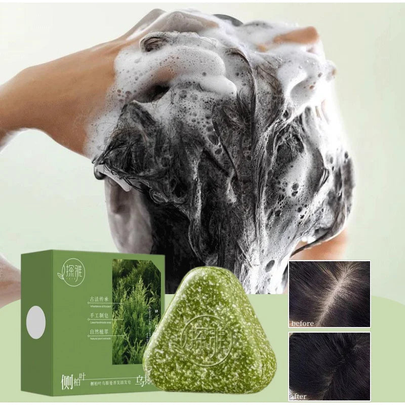 Natural Arborvitae Usman Grass Herbal Shampoo Bar For Hair Growth, Anti Hair Loss Treatment, Oil Control Dandruff Removal Soap